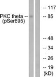 PRKCQ / PKC-Theta Antibody - Western blot of extracts from Jurkat cells treated with EGF 200ng/ml 15', using PKC theta (Phospho-Ser695) Antibody. The lane on the right was incubated with synthetic peptide.