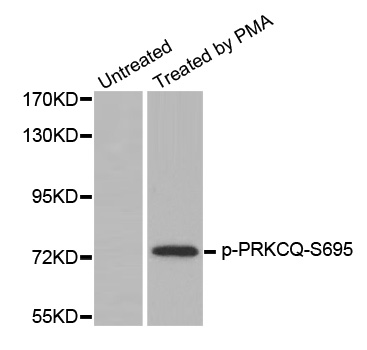 PRKCQ / PKC-Theta Antibody - Western blot analysis of extracts from 293 cells.
