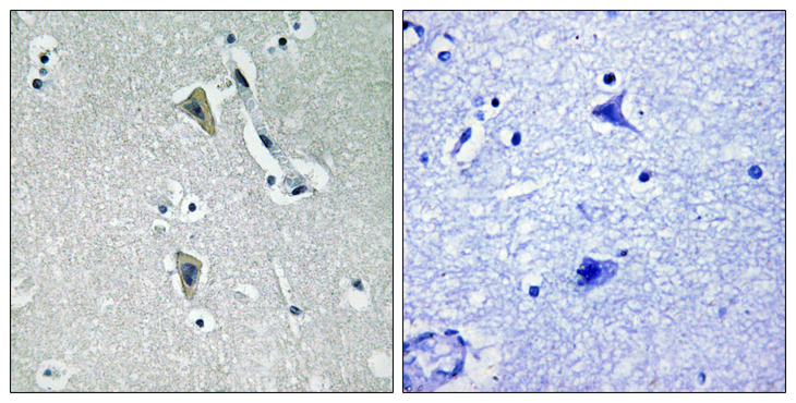 PRKCQ / PKC-Theta Antibody - Immunohistochemistry analysis of paraffin-embedded human brain, using PKC thet (Phospho-Thr538) Antibody. The picture on the right is blocked with the phospho peptide.