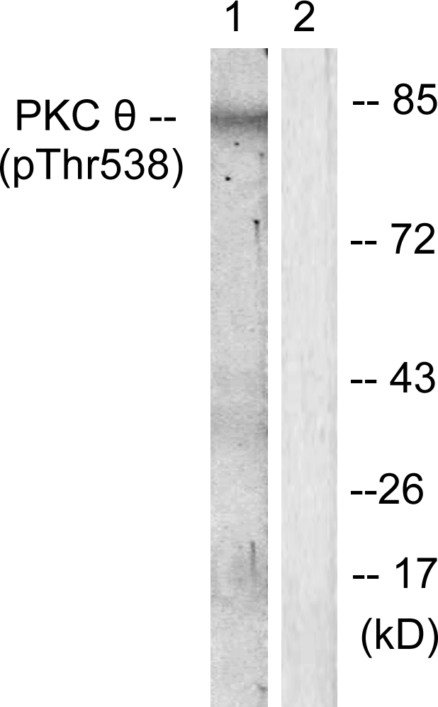 PRKCQ / PKC-Theta Antibody - Western blot analysis of lysates from Jurkat cells, using PKC thet (Phospho-Thr538) Antibody. The lane on the right is blocked with the phospho peptide.