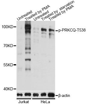 PRKCQ / PKC-Theta Antibody - Western blot analysis of extracts of Jurkat and HeLa cells, using Phospho-PRKCQ-T538 antibody at 1:2000 dilution. Jurkat cells were treated by PMA/TPA (200nM) for 10 minutes.HeLa cells were treated by serum-starvation overnight or treated by PMA/TPA (200nM) for 15 minutes after serum-starvation overnight. The secondary antibody used was an HRP Goat Anti-Rabbit IgG (H+L) at 1:10000 dilution. Lysates were loaded 25ug per lane and 3% nonfat dry milk in TBST was used for blocking. Blocking buffer: 3% BSA.An ECL Kit was used for detection and the exposure time was 30s.