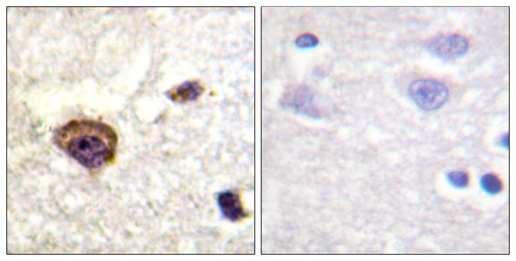 PRKCQ / PKC-Theta Antibody - P-peptide - + Immunohistochemistry analysis of paraffin-embedded human brain tissue using PKC ? (Phospho-Thr538) antibody.