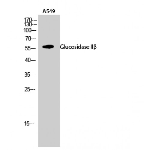 PRKCSH Antibody - Western blot of Glucosidase IIbeta antibody
