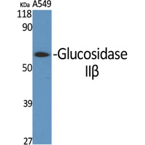 PRKCSH Antibody - Western blot of Glucosidase IIbeta antibody