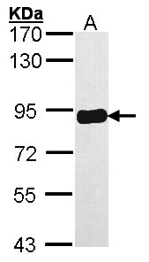 PRKCSH Antibody - Sample (30 ug of whole cell lysate). A: A431 . 7.5% SDS PAGE. PRKCSH antibody diluted at 1:10000.