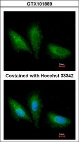 PRKCSH Antibody - Immunofluorescence of paraformaldehyde-fixed A549 using PRKCSH antibody at 1:200 dilution.