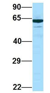 PRKCSH Antibody - PRKCSH antibody Western Blot of HeLa cell lysate. Antibody Dilution: 1.0 ug/ml. PRKCSH is supported by BioGPS gene expression data to be expressed in HeLa. Antibody dilution: 1 ug/ml.  This image was taken for the unconjugated form of this product. Other forms have not been tested.