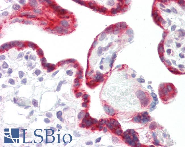 PRKCSH Antibody - Anti-PRKCSH antibody IHC staining of human placenta. Immunohistochemistry of formalin-fixed, paraffin-embedded tissue after heat-induced antigen retrieval.  This image was taken for the unconjugated form of this product. Other forms have not been tested.
