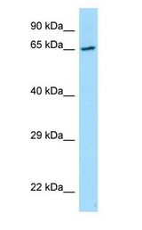 PRKCSH Antibody - PRKCSH antibody Western Blot of RPMI-8226.  This image was taken for the unconjugated form of this product. Other forms have not been tested.
