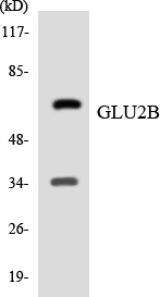 PRKCSH Antibody - Western blot analysis of the lysates from 293 cells using GLU2B antibody.
