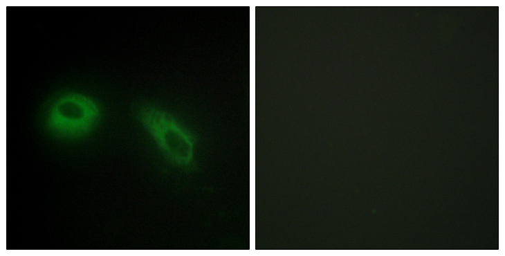 PRKCSH Antibody - Immunofluorescence analysis of HeLa cells, using GLU2B Antibody. The picture on the right is blocked with the synthesized peptide.