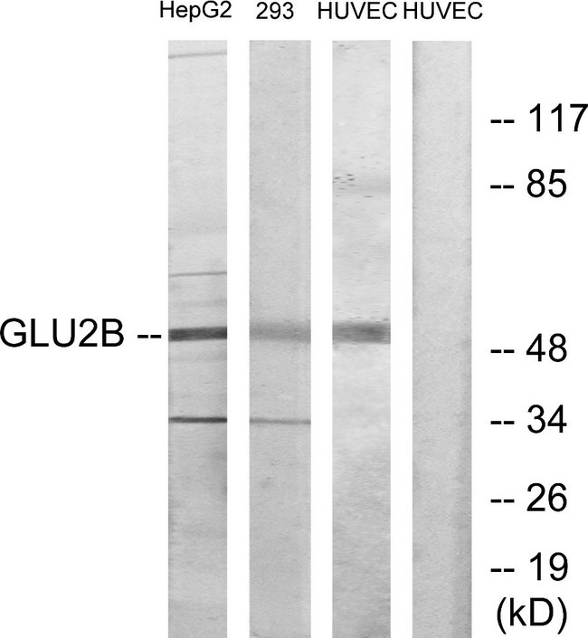 PRKCSH Antibody - Western blot analysis of lysates from HepG2, 293, and HUVEC cells, using GLU2B Antibody. The lane on the right is blocked with the synthesized peptide.