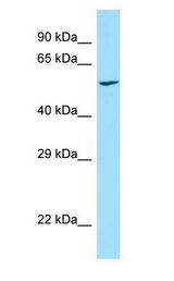 PRKCSH Antibody - PRKCSH antibody Western Blot of Human Kidney.  This image was taken for the unconjugated form of this product. Other forms have not been tested.
