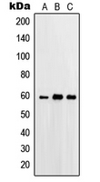 PRKCSH Antibody - Western blot analysis of Beta-glucosidase 2 expression in A431 (A); HeLa (B); A549 (C) whole cell lysates.