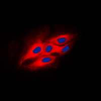 PRKCSH Antibody - Immunofluorescent analysis of Beta-glucosidase 2 staining in HeLa cells. Formalin-fixed cells were permeabilized with 0.1% Triton X-100 in TBS for 5-10 minutes and blocked with 3% BSA-PBS for 30 minutes at room temperature. Cells were probed with the primary antibody in 3% BSA-PBS and incubated overnight at 4 C in a humidified chamber. Cells were washed with PBST and incubated with a DyLight 594-conjugated secondary antibody (red) in PBS at room temperature in the dark. DAPI was used to stain the cell nuclei (blue).