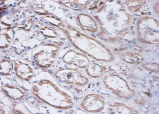 PRKCSH Antibody - Immunohistochemistry of paraffin-embedded human stomach tissue using PRKCSH Antibody at dilution of 1:100