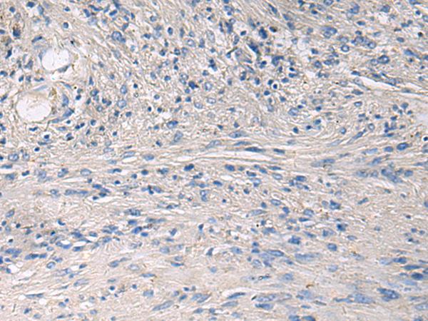 PRKCSH Antibody - Immunohistochemistry of paraffin-embedded Human brain tissue  using PRKCSH Polyclonal Antibody at dilution of 1:65(×200)