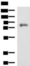 PRKCSH Antibody - Western blot analysis of HepG2 cell lysate  using PRKCSH Polyclonal Antibody at dilution of 1:1350