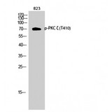 PRKCZ / PKC-Zeta Antibody - Western blot of Phospho-PKC zeta (T410) antibody
