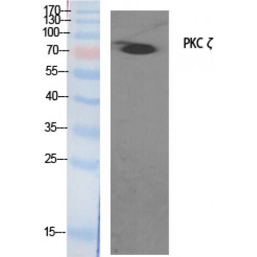PRKCZ / PKC-Zeta Antibody - Western blot of PKC zeta antibody