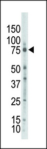 PRKCZ / PKC-Zeta Antibody - Western blot of anti-PKCzeta antibody in placenta lysate. PKCzeta (arrow) was detected using purified antibody. Secondary HRP-anti-rabbit was used for signal visualization with chemiluminescence.