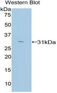 PRKCZ / PKC-Zeta Antibody - Western blot of recombinant PRKCZ / PKC-Zeta.  This image was taken for the unconjugated form of this product. Other forms have not been tested.