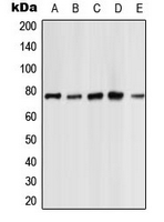 PRKCZ / PKC-Zeta Antibody - Western blot analysis of PKC zeta expression in HeLa (A); NIH3T3 (B); PC12 (C); rat kidney (D); rat heart (E) whole cell lysates.