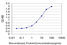 PRKCZ / PKC-Zeta Antibody - Detection limit for recombinant GST tagged PRKCZ is approximately 0.1 ng/ml as a capture antibody.
