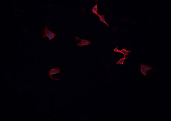 PRKCZ / PKC-Zeta Antibody - Staining NIH-3T3 cells by IF/ICC. The samples were fixed with PFA and permeabilized in 0.1% Triton X-100, then blocked in 10% serum for 45 min at 25°C. The primary antibody was diluted at 1:200 and incubated with the sample for 1 hour at 37°C. An Alexa Fluor 594 conjugated goat anti-rabbit IgG (H+L) Ab, diluted at 1/600, was used as the secondary antibody.