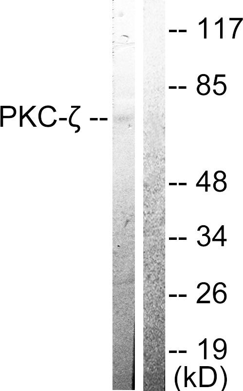 PRKCZ / PKC-Zeta Antibody - Western blot analysis of extracts from 3T3 cells treated with PMA (125ng/ml, 30min), using PKC? (Ab-410) antibody ( Line 1 and 2).