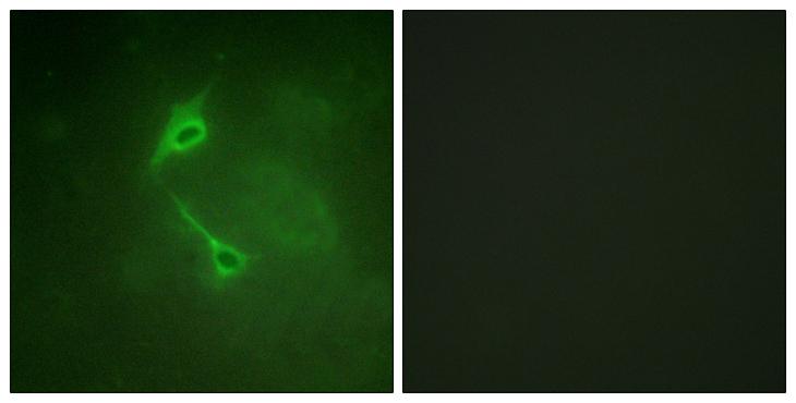 PRKCZ / PKC-Zeta Antibody - Peptide - + Immunofluorescence analysis of NIH/3T3 cells, using PKC ? (Ab-560) antibody.