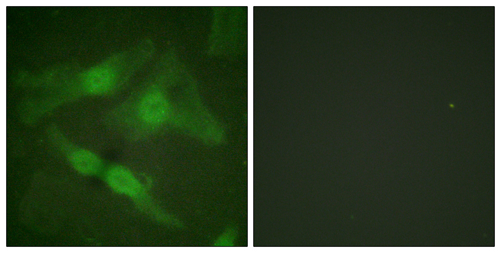 PRKCZ / PKC-Zeta Antibody - Immunofluorescence analysis of HeLa cells, using PKC zeta (Phospho-Thr410) Antibody. The picture on the right is blocked with the phospho peptide.