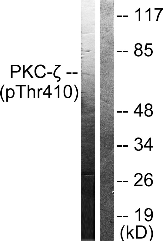 PRKCZ / PKC-Zeta Antibody - Western blot analysis of lysates from NIH/3T3 cells treated with PMA 125ng/ml 30', using PKC zeta (Phospho-Thr410) Antibody. The lane on the right is blocked with the phospho peptide.