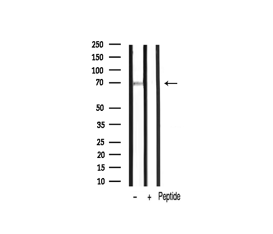 PRKCZ / PKC-Zeta Antibody - Western blot analysis of PKC zeta phosphorylation expression in mouse liver tissue lysates. The lane on the right is treated with the antigen-specific peptide.