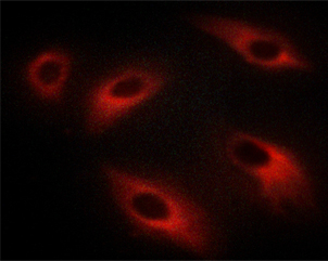 PRKCZ / PKC-Zeta Antibody - Staining C6 cells treated with lambda phosphatase cells by IF/ICC. The samples were fixed with PFA and permeabilized in 0.1% saponin prior to blocking in 10% serum for 45 min at 37°C. The primary antibody was diluted 1/400 and incubated with the sample for 1 hour at 37°C. A Alexa Fluor 594 conjugated goat polyclonal to rabbit IgG (H+L), diluted 1/600 was used as secondary antibody.
