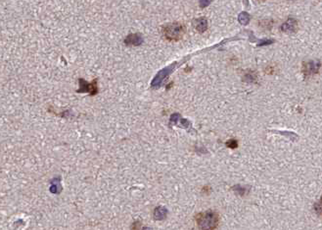 PRKCZ / PKC-Zeta Antibody - 1:100 staining human brain tissue by IHC-P. The tissue was formaldehyde fixed and a heat mediated antigen retrieval step in citrate buffer was performed. The tissue was then blocked and incubated with the antibody for 1.5 hours at 22°C. An HRP conjugated goat anti-rabbit antibody was used as the secondary.
