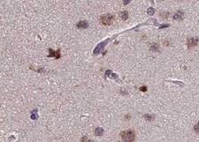 PRKCZ / PKC-Zeta Antibody - 1:100 staining human brain tissue by IHC-P. The tissue was formaldehyde fixed and a heat mediated antigen retrieval step in citrate buffer was performed. The tissue was then blocked and incubated with the antibody for 1.5 hours at 22°C. An HRP conjugated goat anti-rabbit antibody was used as the secondary.