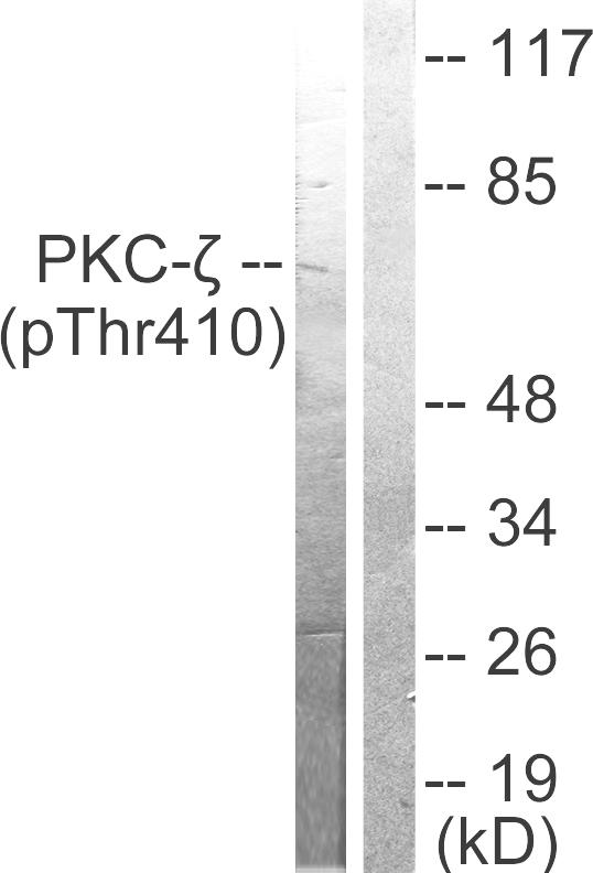 PRKCZ / PKC-Zeta Antibody - Western blot analysis of extracts from NIH/3T3 cells treated with PMA (125ng/ml, 30mins), using PKC? (phospho-Thr410) antibody.