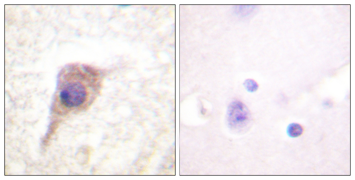 PRKCZ / PKC-Zeta Antibody - Immunohistochemistry analysis of paraffin-embedded human brain, using PKC zeta (Phospho-Thr560) Antibody. The picture on the right is blocked with the phospho peptide.