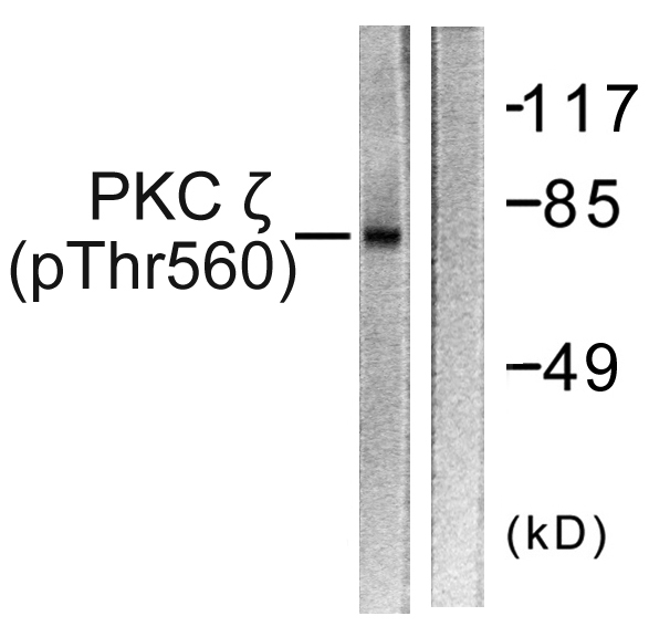 PRKCZ / PKC-Zeta Antibody - Western blot analysis of lysates from COS7 cells treated with PMA 125ng/ml 30', using PKC zeta (Phospho-Thr560) Antibody. The lane on the right is blocked with the phospho peptide.