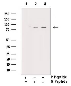 PRKCZ / PKC-Zeta Antibody - Western blot analysis of Phospho-PKC zeta (Thr560) antibody expression in PMA treated COS7 cells lysates. The lane on the right is treated with the antigen-specific peptide.