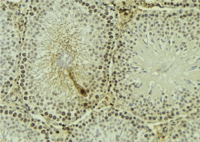 PRKCZ / PKC-Zeta Antibody - 1:100 staining mouse testis tissue by IHC-P. The sample was formaldehyde fixed and a heat mediated antigen retrieval step in citrate buffer was performed. The sample was then blocked and incubated with the antibody for 1.5 hours at 22°C. An HRP conjugated goat anti-rabbit antibody was used as the secondary.