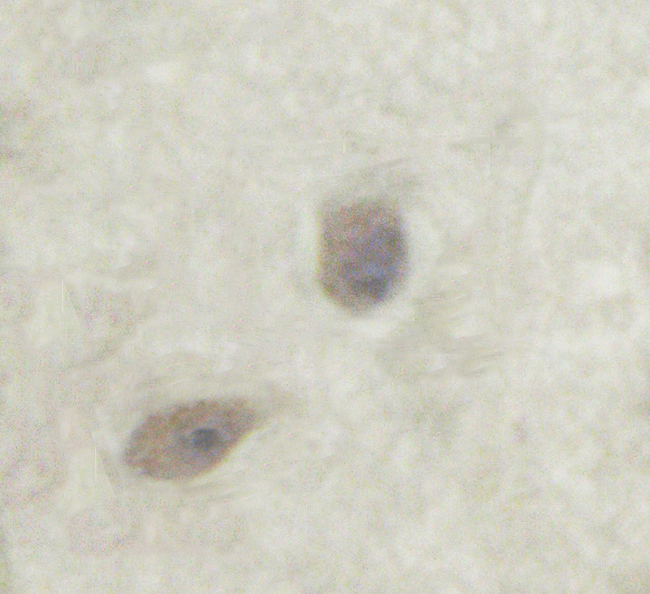 PRKCZ / PKC-Zeta Antibody - 1/100 staining human brain tissue by IHC-P. The sample was formaldehyde fixed and a heat mediated antigen retrieval step in citrate buffer was performed. The sample was then blocked and incubated with the antibody for 1.5 hours at 22°C. An HRP conjugated goat anti-rabbit antibody was used as the secondary antibody.