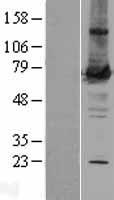 PRKCZ / PKC-Zeta Protein - Western validation with an anti-DDK antibody * L: Control HEK293 lysate R: Over-expression lysate
