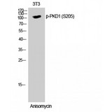 PRKD1 / PKC Mu Antibody - Western blot of Phospho-PKD1 (S205) antibody