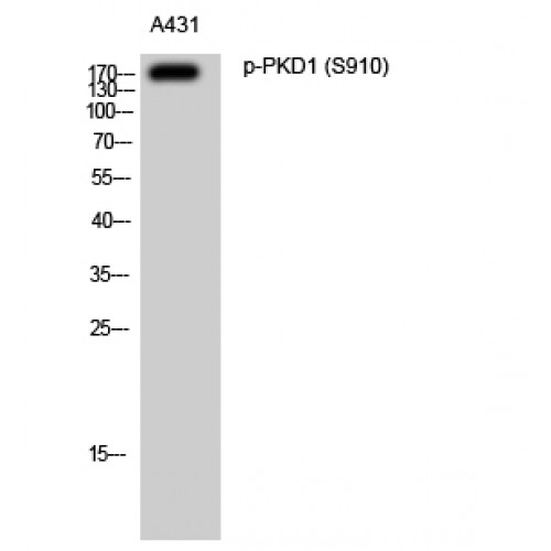 PRKD1 / PKC Mu Antibody - Western blot of Phospho-PKD1 (S910) antibody