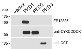 PRKD1 / PKC Mu Antibody - HEK293 lysate overexpressing Human DYKDDDDK-tagged PKD1, Human DYKDDDDK-tagged PKD2 or Human GST-tagged PKD3 probed with antibody (0.1ug/ml) in top panel, probed with anti-DYKDDDDK in middle panel and probed with anti-GST in bottom panel. Data kindly obtai