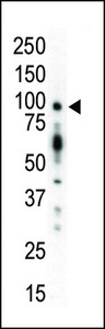 PRKD1 / PKC Mu Antibody - Western blot of anti-PKC mu N-term antibody in mouse kidney lysate. PKC mu (arrow) was detected using purified antibody. Secondary HRP-anti-rabbit was used for signal visualization with chemiluminescence.