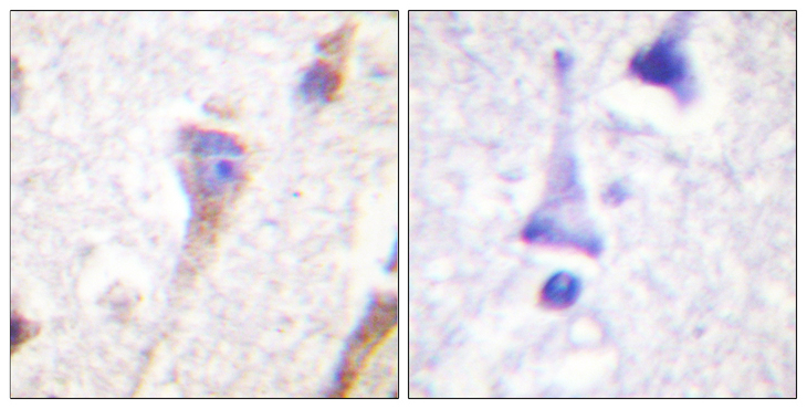 PRKD1 / PKC Mu Antibody - Immunohistochemistry analysis of paraffin-embedded human brain tissue, using PKD1/PKC mu Antibody. The picture on the right is blocked with the synthesized peptide.