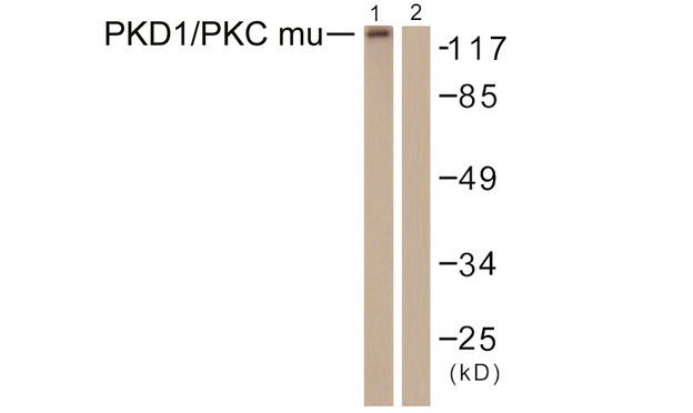 PRKD1 / PKC Mu Antibody - Western blot analysis of lysates from HepG2 cells, using PKD1/PKC mu Antibody. The lane on the right is blocked with the synthesized peptide.